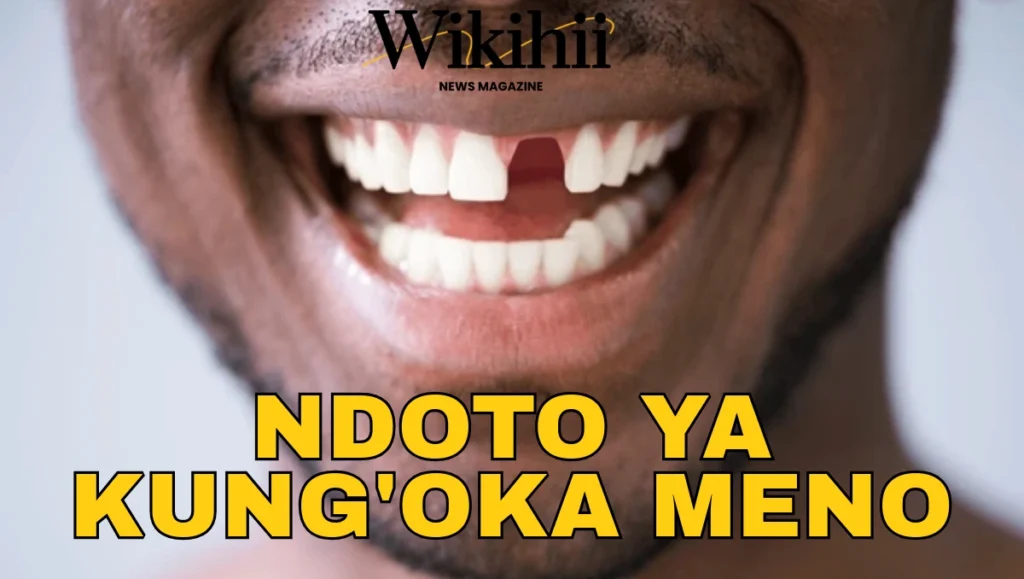 Maana ya Kuota Meno Yanang’oka Katika Ndoto