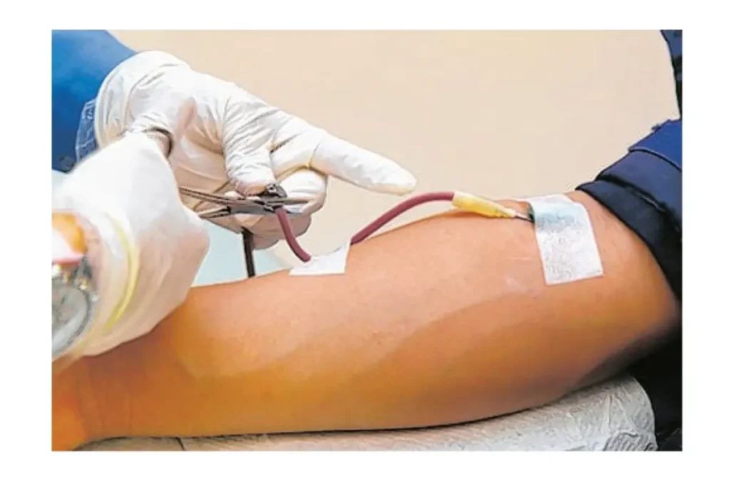 Dalili za Ugonjwa wa Taifodi (Typhoid) – Pamoja na Tiba